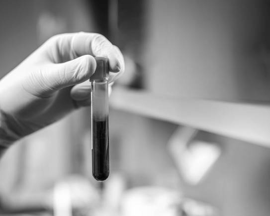 Hand hält Reagenzgals